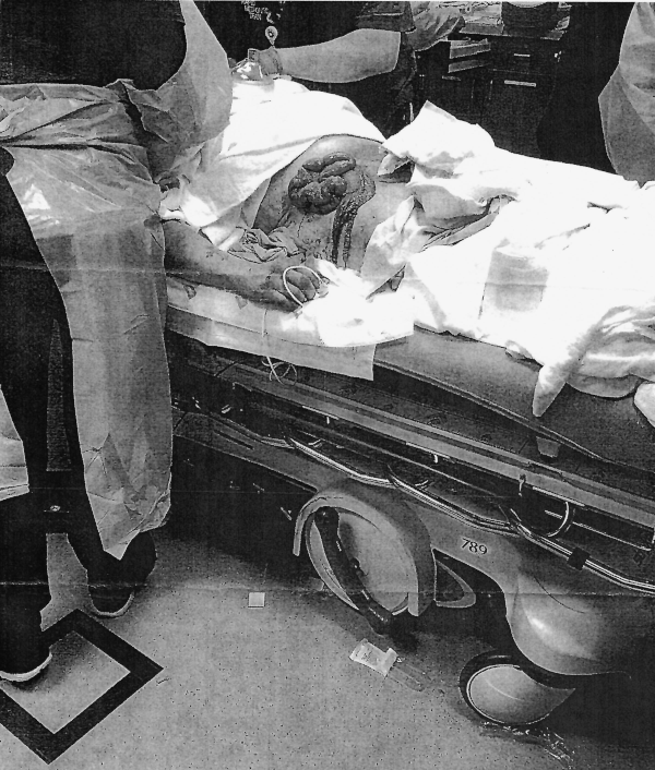 Ketchem being loaded into ambulence showing wound